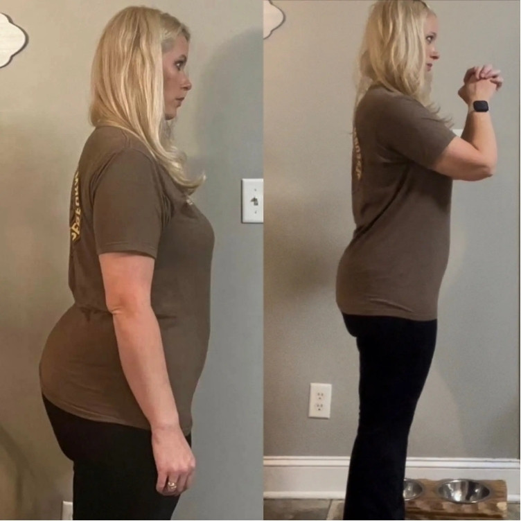 Before and after